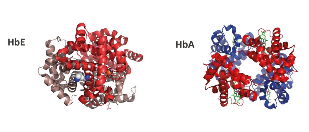 Abnormale Hemoglobines Hemoglobinopathieën