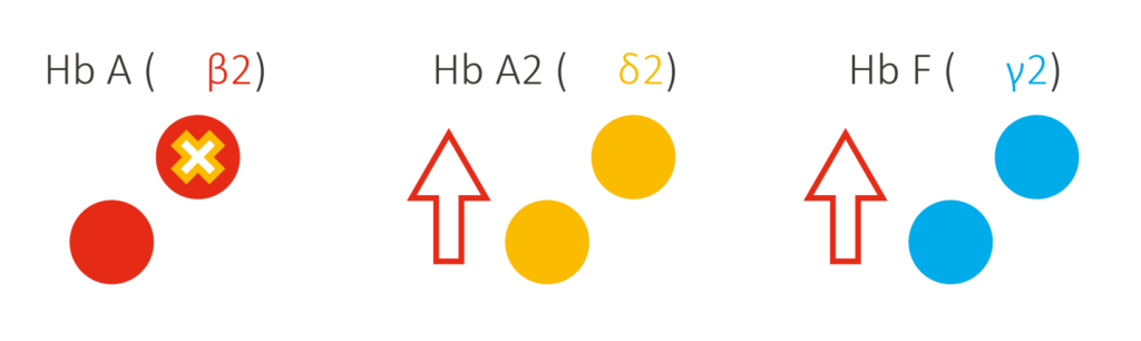 Thalassemie Syndromen Hemoglobinopathieën V2